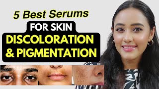 5 Best Serums for DISCOLORATION amp PIGMENTATION Serums to treat twotone skin amp get even skin tone [upl. by Hallett252]