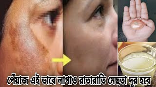 পেঁয়াজের রসে কি মেশালে খুব তারাতাড়ি মেছতা দূর হয়ে দাগহীন ফর্সা ত্বক পাবেনmesta dur korar upay [upl. by Anesusa600]