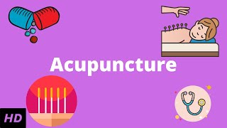 Acupuncture What You Need to Know [upl. by Merce]