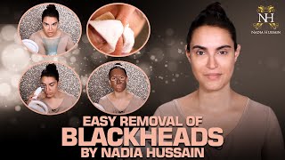 How to Remove Blackheads and Whiteheads [upl. by Inaej]