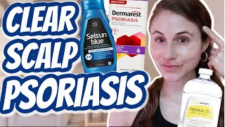 How to CLEAR SCALP PSORIASIS Dr Dray [upl. by Sandro]