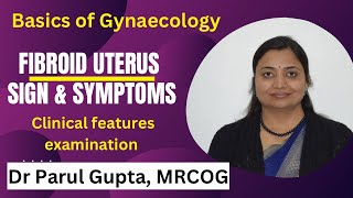 Uterine Fibroid  Sign amp Symptoms  Clinical features [upl. by Adnoluy]