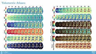 OHBM 2023  3080  Talk  Khoi Huynh  Longitudinal atlases of cortical and subcortical tissue mic… [upl. by Ahsille627]