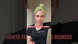 HOW TO FADE POSTACNE REDNESS dermatologist DrDrayzday [upl. by Avictor712]