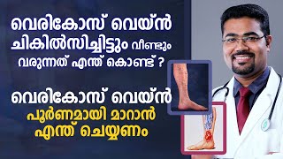 വെരികോസ് വെയ്ൻ പൂർണമായി മാറാൻ എന്ത് ചെയ്യണം  Varicose vein Treatment Malayalam  Arogyam [upl. by Lewanna579]