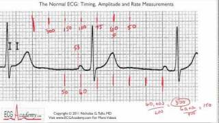 Determining Rate 63  ECG  EKG Interpretation  BASIC [upl. by Hut]