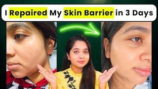 How I Repaired My Skin Barrier in 3 days at Home with Minimal Skincare Products [upl. by Gabbi]