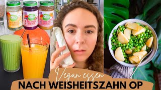 VEGANES FOOD DIARY » Essen nach Weisheitszahn OP Erfahrungsbericht amp Tipps│Food Friday 64 [upl. by Merilee434]