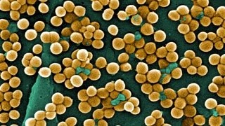 Science Bulletins MRSA—The Evolution of a DrugResistant Superbug [upl. by Anilesor636]