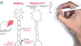 Pharmacology  Parkinsons Disease [upl. by Ellehsal144]