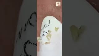 Blackheads Removal  Acne Treatment and Very Satisfying Satisfying Pimple pop blackheads [upl. by Ritch513]