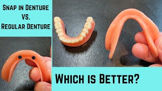 Why a lower snap in denture is better than a lower regular denture [upl. by Nabetse]