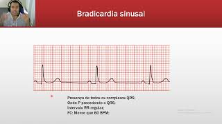 Taquiarritmias e Bradiarritmias [upl. by Crespo]