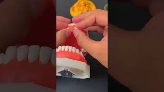 A Comprehensive Guide to Using Tooth Repair Kits Effectively youtubeshorts [upl. by Barnet628]