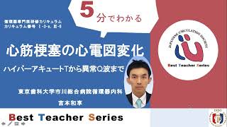 日本循環器学会 5分でわかる循環器Best Teacher Series 心筋梗塞の心電図変化 ハイパーアキュートTから異常Q波まで 東京歯科大学市川総合病院循環器内科 宮本 和享 [upl. by Oirasor80]