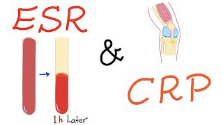 ESR and CRP [upl. by Lucio]