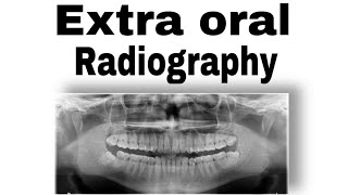 اشعة  extra oral radiography  طب الاسنان مرحلة ثالثة Radiology [upl. by Nnazil]