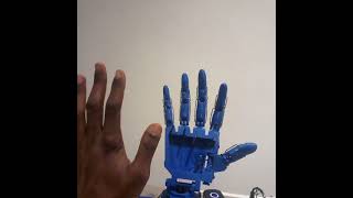 myoelectric prosthetic hand [upl. by Liebermann22]