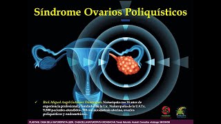 HERBOLARIA Y NATUROPATIA PARA SINDROME OVARIOS POLIQUISTICOS BIOL MIGUEL ANGEL GUTIERREZ DOMINGUEZ [upl. by Annaitsirk]