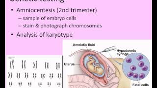 Errors in Meiosis [upl. by Alfredo22]