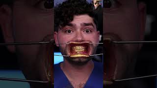 Gold teeth with golden toothpaste 🦷 yt viral ytshorts argal [upl. by Weinert656]