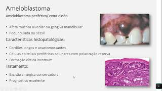 Tumores Odontogênicos  Resumos de Odonto [upl. by Hong]