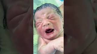 This newborn has a lot of amniotic fluid on his body and the nurse helps to wipe his body [upl. by Ayel]