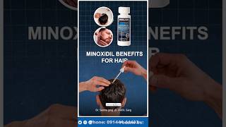 Minoxidil Hair Regrowth Results ytshorts shortsvideo minoxidil [upl. by Peri961]