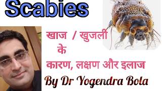 SCABIES COMPLETE CURE and treatment by DR YOGENDRA BOLA in hindiरात को होने वाली खुजली का इलाज [upl. by Shaver433]