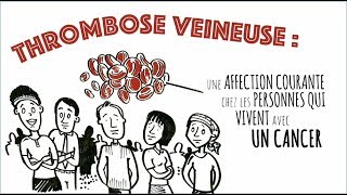 Thrombose Veineuse et Cancer [upl. by Niro]