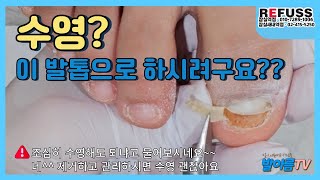 조심히 수영해도 되냐고 물어보시네요QKFQJqkqkfxhq 발톱 발관리 박리 레푸스 toenail refuss [upl. by Fonseca]