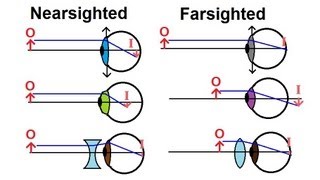 Physics  Optics Vision Correction 1 of 5 Introduction [upl. by Zsamot]