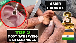 Ear Cleaning On Indian Street Top 3 of February Big black earwax pieces Asmr ear cleaning [upl. by Creamer851]