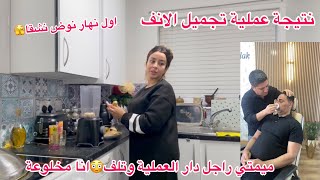 درتها لراسي🫨راجل دار عملية تجميل وتسيف وتزادت فيه ظلعة😰نتيجة الانفاول نهار نطيب بعد سفردردشة معا [upl. by Brightman432]