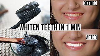 DIY Natural Toothpaste To Whiten Teeth at Home in 1 Minute  Bentonite Clay Teeth Whitening [upl. by Elleiad]