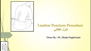 Lumbar Puncture Procedure  البزل القطني [upl. by Oates349]