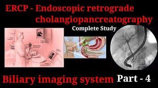 ERCP Procedure  Endoscopic retrograde cholangiopancreatography  biliary imaging system part 3 [upl. by Lainahtan]