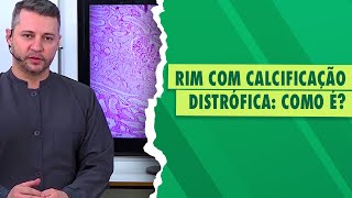 Patologia Veterinária Calcificação Distrófica [upl. by Parrott]