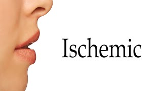 How To Say Ischemic [upl. by Attenwad408]