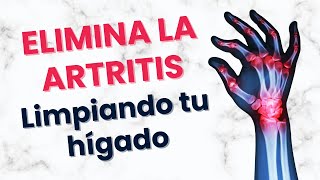 ELIMINA LA ARTRITIS LIMPIANDO TU HIGADO  Dra Montserrat  Cuerpo en Sintonía Ep 21 [upl. by Ensoll]