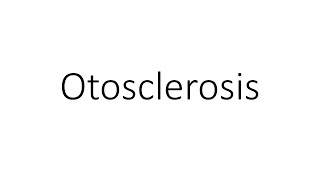 Otosclerosis  Quick Revision  ENT [upl. by Oile]