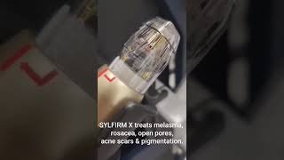 SYLFIRM X Ultimate Edition Dual Wave RF Microneedling Facial Treatment [upl. by Aneg326]