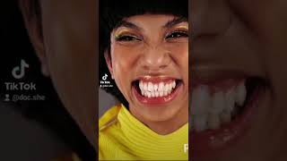 Mimiyuuuhs teeth TEETH WITH GAP OR SPACES TREATMENT  EXTRA TOOTH REMOVAL [upl. by Enylcaj]