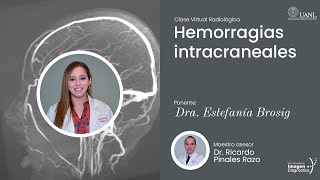 Hemorragias intracraneales por la Dra Estefanía Brosig [upl. by Fu536]