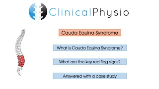 Red Flag Review Cauda Equina Syndrome  Clinical Physio [upl. by Nirmak]