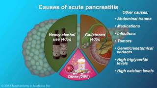 Acute Pancreatitis [upl. by Araeic]