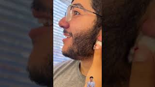 Pimple popping  pimple blackheads amp blackheads treatment [upl. by Ahsircal]