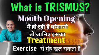 Trismus Treatment Causes and Symptoms  Problem in mouth opening [upl. by Yanarp]