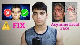 How to fix Asymmetrical  Uneven Face Naturally  How I Fixed my face Asymmetry in Just 60 Days [upl. by Gamal]