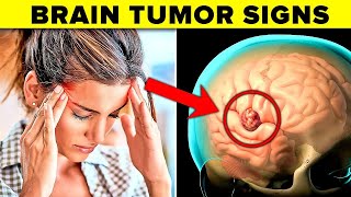 9 Warning Signs Of A Brain Tumor IMPORTANT [upl. by Massimo]